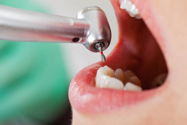 Best Tooth Pain Emergency Relief  in Forney, TX
